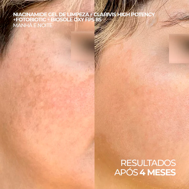Protetor Solar Facial 12HS Clareador 15 Tipos de Manchas – Biosole Oxy FPS 85 40ml - Imagem 3
