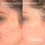 Protetor Solar 12HS Organo Mineral Antioleosidade para Pele Oleosa – Normalize Solar Matte Intense FPS 50 40g - Imagem 8